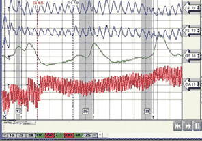 Fontana polygraph test